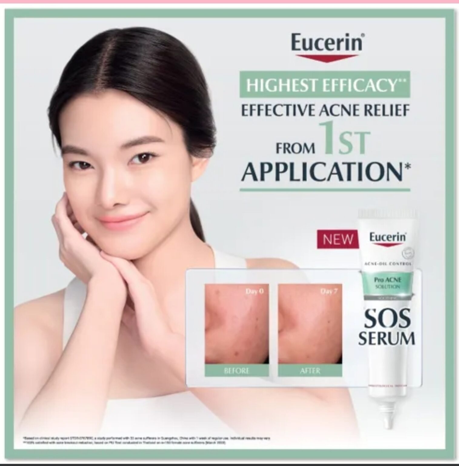 Phentermine Acne: Expert Advice & Treatment Strategies - 3cn5pu8